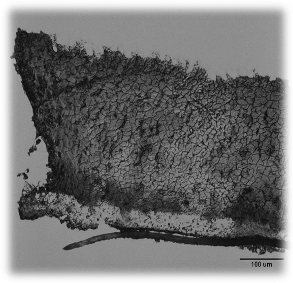 micrograph of cryosectioned 3 species colony biofilm of chronic wound isolates